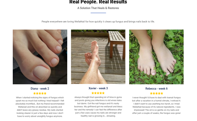 WellaNail Fungus Treatment Clean Ingredients Take Center Stage in 2025’s Challenge Against Stubborn Nail Fungus”